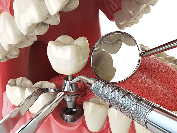 Best Emergency TMJ Treatment in Montrose, MN